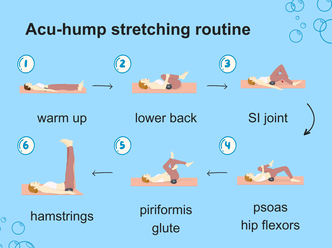 release piriformis syndrome with stretching